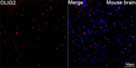 OLIG2 Recombinant Rabbit Monoclonal Antibody (7L2X9)