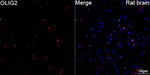 OLIG2 Antibody in Immunohistochemistry (Paraffin) (IHC (P))