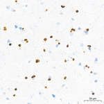 OLIG2 Antibody in Immunohistochemistry (Paraffin) (IHC (P))