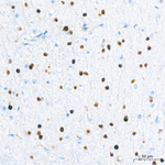 OLIG2 Antibody in Immunohistochemistry (Paraffin) (IHC (P))