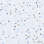 OLIG2 Antibody in Immunohistochemistry (Paraffin) (IHC (P))