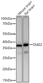 OLIG2 Antibody in Western Blot (WB)