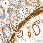 Vinculin Antibody in Immunohistochemistry (Paraffin) (IHC (P))