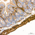 Vinculin Antibody in Immunohistochemistry (Paraffin) (IHC (P))