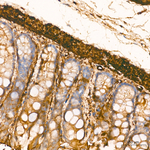 Vinculin Antibody in Immunohistochemistry (Paraffin) (IHC (P))