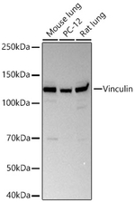 Vinculin Antibody in Western Blot (WB)