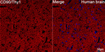 CD90 Antibody in Immunohistochemistry (Paraffin) (IHC (P))