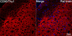 CD90 Antibody in Immunohistochemistry (Paraffin) (IHC (P))