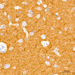 CD90 Antibody in Immunohistochemistry (Paraffin) (IHC (P))