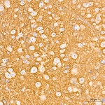 CD90 Antibody in Immunohistochemistry (Paraffin) (IHC (P))