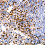 CD90 Antibody in Immunohistochemistry (Paraffin) (IHC (P))