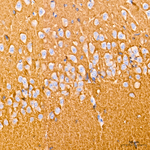 CD90 Antibody in Immunohistochemistry (Paraffin) (IHC (P))