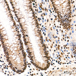 H3K4me1 Antibody in Immunohistochemistry (Paraffin) (IHC (P))