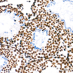 H3K4me1 Antibody in Immunohistochemistry (Paraffin) (IHC (P))