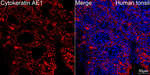 Cytokeratin 10/14/15/16/19 Antibody in Immunohistochemistry (Paraffin) (IHC (P))