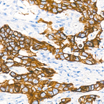 Cytokeratin 10/14/15/16/19 Antibody in Immunohistochemistry (Paraffin) (IHC (P))