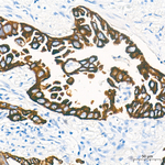 Cytokeratin 10/14/15/16/19 Antibody in Immunohistochemistry (Paraffin) (IHC (P))
