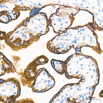 Cytokeratin 10/14/15/16/19 Antibody in Immunohistochemistry (Paraffin) (IHC (P))