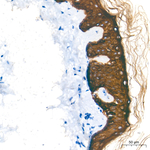 Cytokeratin 10/14/15/16/19 Antibody in Immunohistochemistry (Paraffin) (IHC (P))