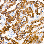 Cytokeratin 10/14/15/16/19 Antibody in Immunohistochemistry (Paraffin) (IHC (P))