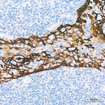 Cytokeratin 10/14/15/16/19 Antibody in Immunohistochemistry (Paraffin) (IHC (P))