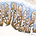 Cytokeratin 10/14/15/16/19 Antibody in Immunohistochemistry (Paraffin) (IHC (P))