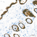 Cytokeratin 10/14/15/16/19 Antibody in Immunohistochemistry (Paraffin) (IHC (P))