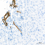Cytokeratin 10/14/15/16/19 Antibody in Immunohistochemistry (Paraffin) (IHC (P))
