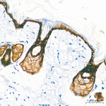 Cytokeratin 10/14/15/16/19 Antibody in Immunohistochemistry (Paraffin) (IHC (P))