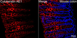 Cytokeratin 10/14/15/16/19 Antibody in Immunohistochemistry (Paraffin) (IHC (P))