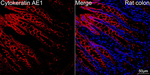 Cytokeratin 10/14/15/16/19 Antibody in Immunohistochemistry (Paraffin) (IHC (P))