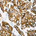 Cytokeratin 10/14/15/16/19 Antibody in Immunohistochemistry (Paraffin) (IHC (P))