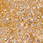 Cytokeratin 10/14/15/16/19 Antibody in Immunohistochemistry (Paraffin) (IHC (P))