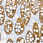 Cytokeratin 10/14/15/16/19 Antibody in Immunohistochemistry (Paraffin) (IHC (P))