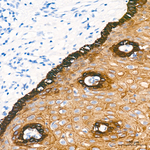 Cytokeratin 10/14/15/16/19 Antibody in Immunohistochemistry (Paraffin) (IHC (P))