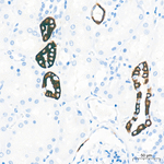 Cytokeratin 10/14/15/16/19 Antibody in Immunohistochemistry (Paraffin) (IHC (P))