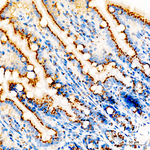 GM130 Antibody in Immunohistochemistry (Paraffin) (IHC (P))