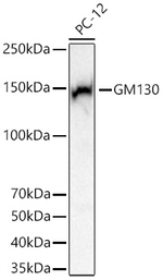 GM130 Antibody in Western Blot (WB)