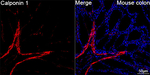 Calponin 1 Antibody in Immunohistochemistry (Paraffin) (IHC (P))