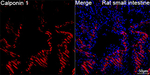 Calponin 1 Antibody in Immunohistochemistry (Paraffin) (IHC (P))