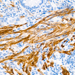 Calponin 1 Antibody in Immunohistochemistry (Paraffin) (IHC (P))