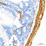 Calponin 1 Antibody in Immunohistochemistry (Paraffin) (IHC (P))