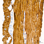 Calponin 1 Antibody in Immunohistochemistry (Paraffin) (IHC (P))