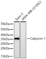 Calponin 1 Antibody in Western Blot (WB)