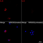 IL-6 Antibody in Immunocytochemistry (ICC/IF)
