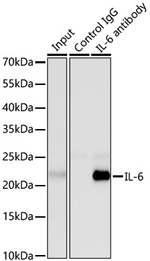 IL-6 Antibody in Immunoprecipitation (IP)