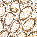 KIAA1429 Recombinant Rabbit Monoclonal Antibody (8D6C1)