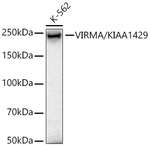 KIAA1429 Antibody in Western Blot (WB)