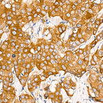 IDE Antibody in Immunohistochemistry (Paraffin) (IHC (P))