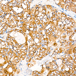 IDE Recombinant Rabbit Monoclonal Antibody (4E2G2)